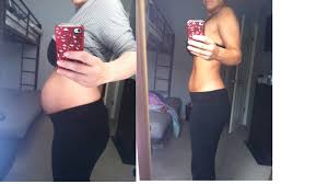 Postpartum Twin Belly Twin Belly Postpartum Belly Skin Tightening Stomach