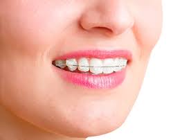 In mexico braces cost goes from $500 usd to $4500 usd it all depends on the type of braces. Dentist In Kl Selangor Klang Valley St Tiew Dental Clinic Malaysia