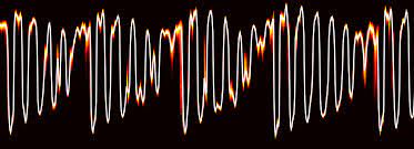 Wavenet A Generative Model For Raw Audio Deepmind It Generates Natural Sounding Human Voices And Music From De Generative Neural Networks Speech Synthesis