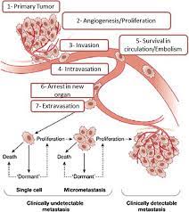 What is metastatic breast cancer (also known as stage 4 breast cancer), and what are its the symptoms may vary, depending on how far your breast cancer has spread and what type of tissue other nonspecific systemic symptoms of metastatic breast cancer can include fatigue, weight loss. Metastatic And Triple Negative Breast Cancer Challenges And Treatment Options Springerlink