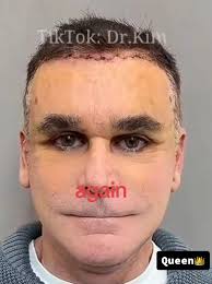 Dr Kim Spain Client Healed