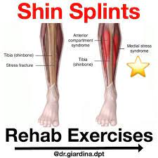Pin On Injuries