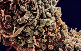 Nih says trial data may give incomplete view of astrazeneca vaccine. Single Dose Of Oxford Astrazeneca Covid Vaccine Shown To Be More Immunogenic Than Natural Infection
