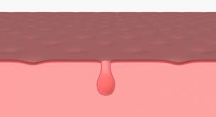 3d Model Anatomy Skin Medical Cross Section Human Slice Doctor Pore Epidermis Surface System Internal Organ Inner Sen Skin Pores 3d Model Pore