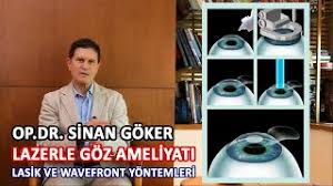Lazerle Goz Ameliyati Nasil Yapilir Ve Fiyatlari 2020 Youtube