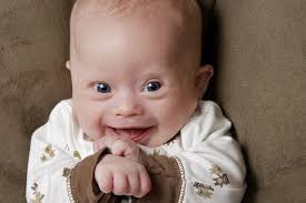 Baby Noah 3 Months Old Today Down Syndrome Baby Beautiful Children Down Syndrome Kids
