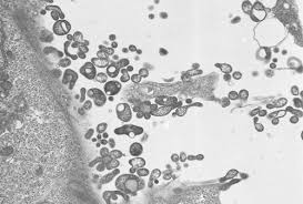Image result for Mycoplasma