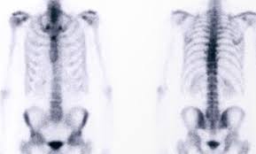 Sie suchen informationen zur szintigraphie und spezialisten für die untersuchung? Szintigraphie Und Spect Ct Mri Zurich
