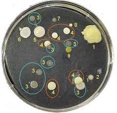 Image Result For Petri Dish Bacteria Identification Chart