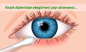 Kirpik Dibi Iltihabi Bitkisel Tedavisi Ibrahim Saracoglundan Blepharitis Blepharitis Treatment Eyelid Cleaning