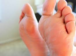 Want to know how to make your feet soft? 10 Home Remedies To Get Rid Of Dead Skin On Feet Fort Worth Podiatry Ankle And Foot Institute Of Texas