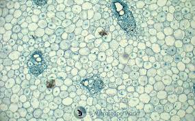 Check spelling or type a new query. Microscope World Blog Plant Cell Images From Student Microscope