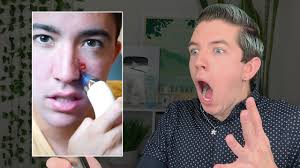Entdecke rezepte, einrichtungsideen, stilinterpretationen und andere ideen zum ausprobieren. Specialist Reacts To Tik Tok Acne Hacks Youtube