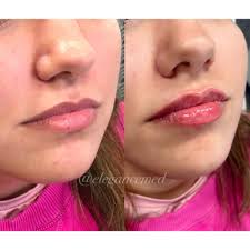 Elegance Medical Aesthetics & Laser Clinic‎