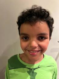 Meet Kaiden and learn about the heart breaking reason his appearance