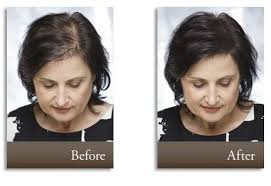 Thinning hair and bald patches are surprisingly common in women. Hair Building Fibers And Thinning Hair Solutions Toppik Com Hairstyles For Thin Hair Thin Fine Hair Thin Hair Solutions