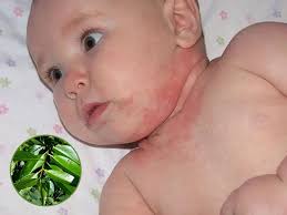 Tắm lá vối có tác dụng gì cho trẻ sơ sinh?