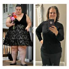Check spelling or type a new query. Bariatric Patient Testimonials Prime Surgicare