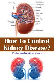 Polycystic Kidney Disease Dialysis Gerd Kidney Disease Are Apples Good For Dogs With Kidney Di Polycystic Kidney Disease Kidney Disease Kidney Disease Symptoms