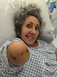 Hi everyone, I lost my left 2 years ago May and it's been so hard. Due to a  stroke I can't use my left hand and have to have help putting my