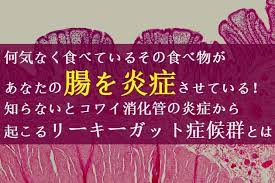 食後 なんとなく調子が悪い そんな経験はありませんか 食事は毎日するものなので 何を食べて具合が悪くなったのか把握することはよほど意識して一字一句記録しない限り難しいことです あなたが好んで毎日習慣的に食べているものが もしかすると不調の原因に