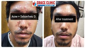 List of nearest Dietitians For Children in Dehradun Cantt, Dehradun