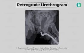 Image result for Retrograde Urethrogram