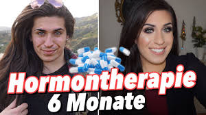 Transgender sind menschen, die sich mit ihrem geburtsgeschlecht nur teilweise oder gar nicht identifizieren können. Hormontherapie 6 Monate Transformation Jolina Mennen Youtube