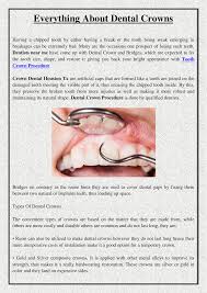 How to make teeth stronger naturally: Everything About Dental Crowns