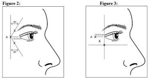 Botox Cosmetic Dosage Guide Drugs Com