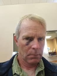 I was walking around the farm without my glasses when I suddenly fell into  some deep water....apparently without my glasses, i cannot see that well.