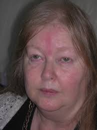 Hilary Porter Actual Abduction Marks