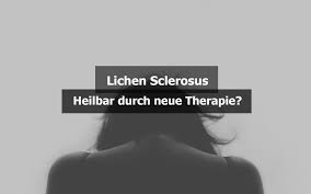 The disease can also appear on the upper body, breasts, and upper arms. Lichen Sclerosus Symptome Behandlung Heilung Praktischarzt