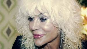 She became successful in 1979 when she recorded the album brivido divino. Donatella Rettore Dopo L Intervento Ho Sentito Affetto E Amore Intorno A Me La Repubblica