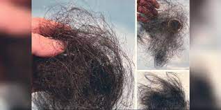 Covid 19 Could Cause Your Hair To Fall Out
