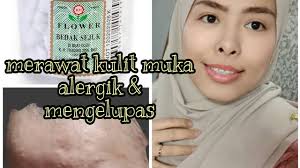 Produk kami adalah 100% dari tanah liat dan mempunyai banyak khasiat kepada lelaki dan perempuan, sesuai bagi semua peringkat umur, amalkan menyapu di. Rawat Kulit Mengelupas Pedih Alergik Dgn Bedak Sejuk Harga Murah Youtube