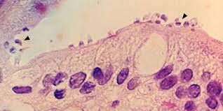 Cryptosporidium parvum is a coccidian parasite that affects the intestinal and respiratory epithelium of vertebrates. Cryptosporidium Compare Europe