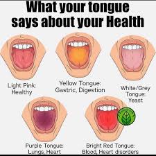 Image result for yellow tongue infection