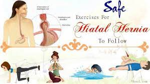 May 22, 2020 · a hiatal hernia involves part of the stomach protruding into the chest through an opening in the diaphragm. 16 Safe Exercises For Hiatal Hernia To Follow