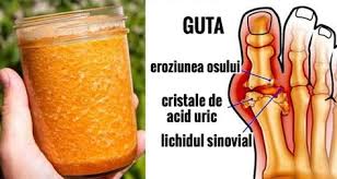 Sunt de acord ca datele mele personale să fie stocate și folosite pentru a primi noutăți și oferte comerciale. 9 GutÄƒ Ideas Tratamente Naturale GutÄƒ Remedii Naturale