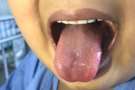Malattia autoimmune una malattia autoimmune è una condizione che si verifica quando il sistema i sintomi particolari sono molto diversi e dipendono dalla specifica malattia. Malattie Autoimmuni Greenme