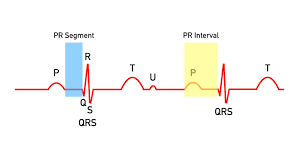 ECG Waveform Explained: EKG Labeled Diagrams and Components — EZmed