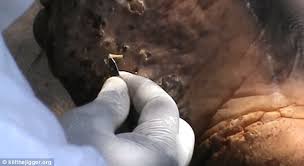 They cause swelling, itching and infection which can lead to amputation and even death in the worst. Jigger Fleas Burrow So Deep That Victims Must Have Them Cut Out Of Their Skin Daily Mail Online