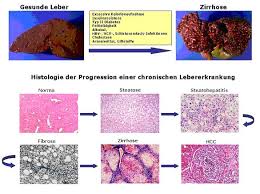 Zu weihnachten und silvester wird meist viel getrunken und gegessen. Verhangnisvolle Signale Universitat Heidelberg
