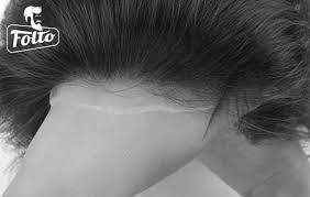 Diversamente i costi per quelle tradizionali dovrebbero variare tra 500 e 2000 €, anche se possono facilmente trovarsi in commercio anche protesi molto spesse e . Protesi Per Capelli Quanto Costa Qual E Il Giusto Prezzo