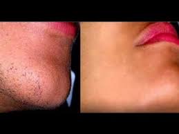 I am doing good and hope everything is doing good at your end. Home Remedies To Remove Facial Hair Permanently Female Facial Hair Face Hair Removal Remove Facial Hair Permanently