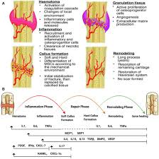 Diagram of of a long bone. 6 Vgt V5pjrnpm