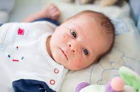 My baby has a rash on his face. Baby Rash A Visual Guide To Skin Rashes In Babies And Children