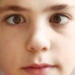 Facial weakness: A dark matter detective story