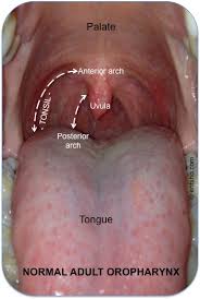Image result for Tonsillitis